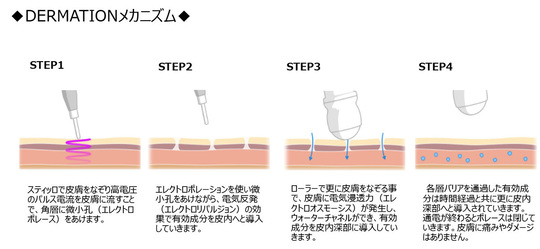 エレクトロポレーション DERMAION（ﾃﾞﾙﾏｼｵ） - 相模原市でエステなら